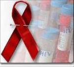 Identifican moléculas que impiden el desarrollo del SIDA